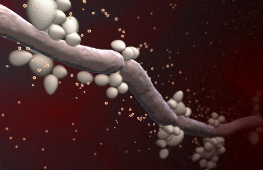 candidiasis